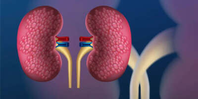 acute-kidney-injurysingle-consultation-large-2022-05-26-05-25-13-16180